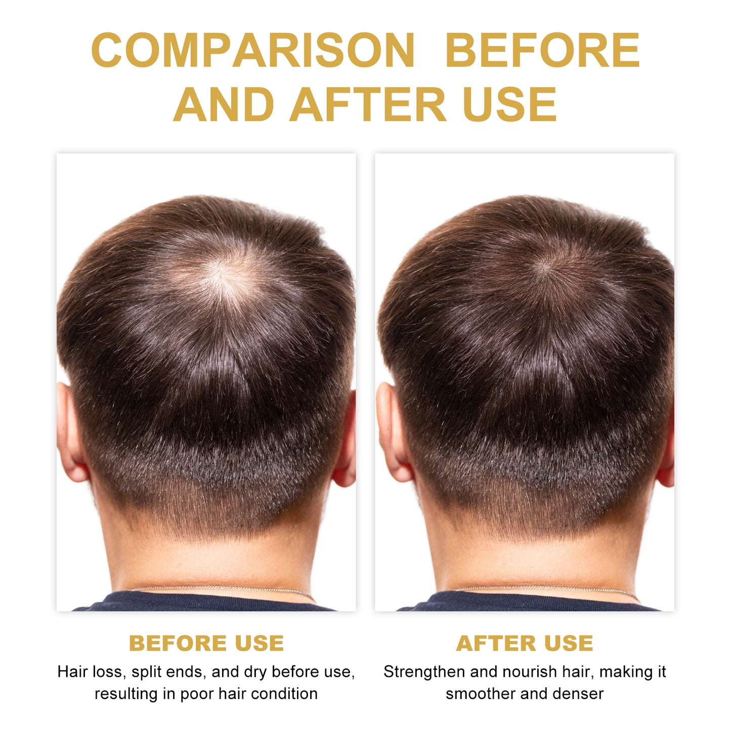 EELHOE Rosemary Hair Treatment Oil for Dry & Frizzy Hair – Scalp Cleansing, Deep Conditioning, Volumizing & Smoothing Repair Formula