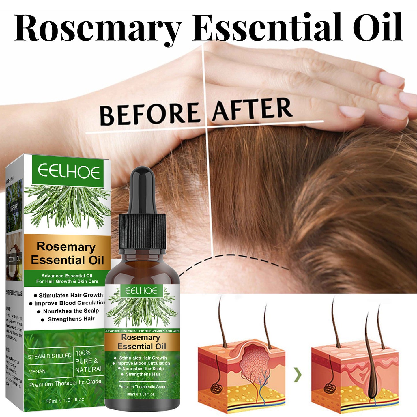 Before and after showing Rosemary Hair Oil application promoting scalp care and hair growth.