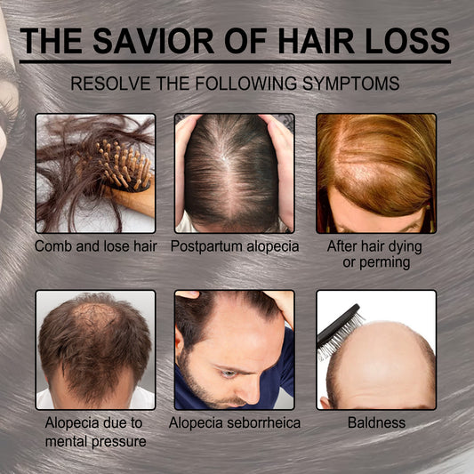 Image illustrating common symptoms of hair loss, including postpartum alopecia and baldness.