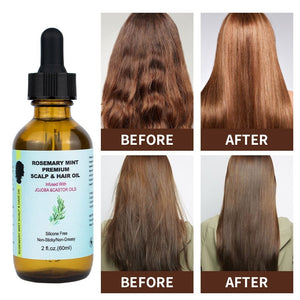 Hair Care Essential Oil Rosemary And Castor Oil For Smoothness