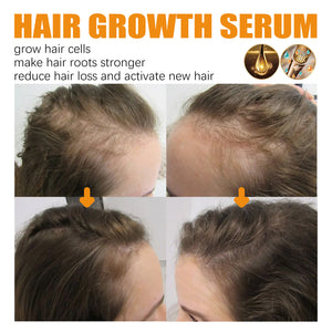 Hair Growth Nourishing Oil