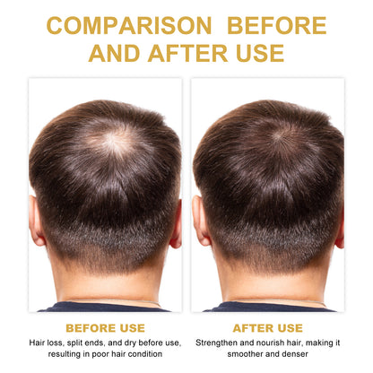 EELHOE Rosemary Hair Treatment Oil for Dry & Frizzy Hair – Scalp Cleansing, Deep Conditioning, Volumizing & Smoothing Repair Formula